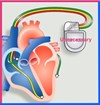 CRT-ICD causes that you cannot start symmetrybody-concept.