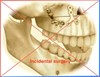 incidentele chirurgie; operatie bovenkaak en onderkaak "malacclusie"- SYMMETRYBODY